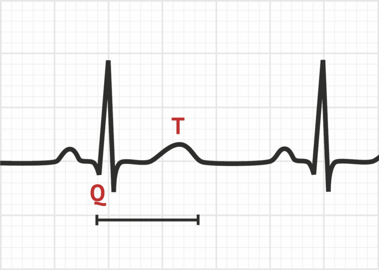 qtc-calculator-definition-formula-example